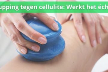 werkt cupping tegen cellulite