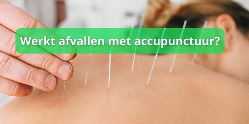 accupunctuur afvallen