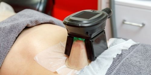 Cryolipolyse apparaat