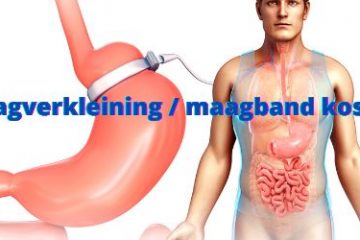 Maagverkleining maagband kosten