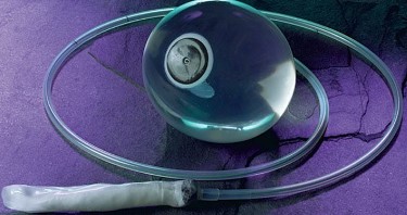 Maagballon via slokdarm